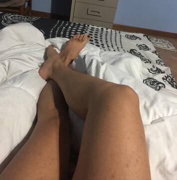 Foto pública de exoticain